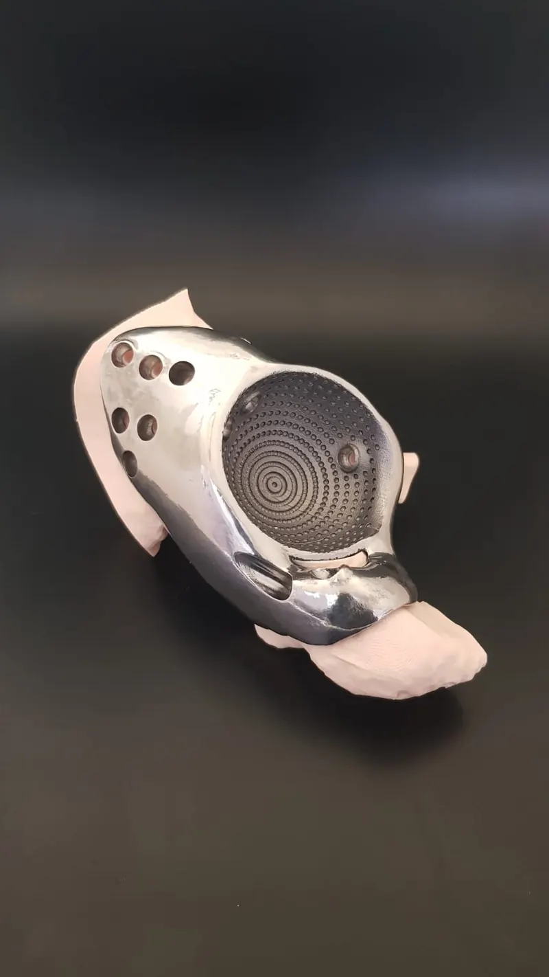Kişiye özel kraniyal implant örneği